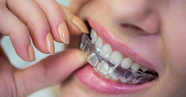 Invisible Orthodontics